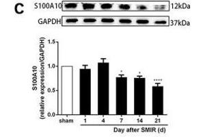 Astrocytes were activated and mainly expressed as the A1 phenotype in the spinal cord after SMIR. (GAPDH Antikörper)