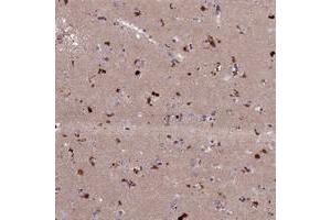 Immunohistochemical staining of human lateral ventricle with ADO polyclonal antibody  shows strong cytoplasmic positivity in neuronal cells. (ADO Antikörper)
