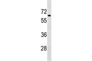 Western Blotting (WB) image for anti-Transforming Growth Factor, beta Receptor II (70/80kDa) (TGFBR2) (AA 548-575) antibody (ABIN3029225)