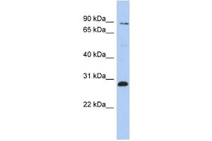WB Suggested Anti-ZNF148 Antibody Titration:  0. (ZNF148 Antikörper  (Middle Region))