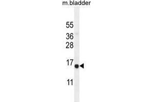 Western blot analysis in mouse bladder tissue lysates (35ug/lane) using CHIC2 antibody .