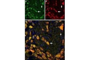 Multiplex staining of NK1 Receptor and mGluR5 in rat DRG - Immunohistochemical staining of rat dorsal root ganglion using Anti-Neurokinin 1 Receptor (NK1R) (extracellular)-ATTO Fluor-488 Antibody (ABIN7043804), (green), (1:60) and Anti-mGluR5 (extracellular)-ATTO Fluor-594 Antibody (ABIN7043251), (red), (1:60).