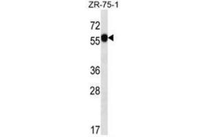 C6orf211 Antibody (N-term) western blot analysis in ZR-75-1 cell line lysates (35µg/lane). (C6ORF211 Antikörper  (N-Term))