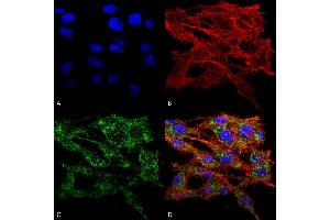 Immunocytochemistry/Immunofluorescence analysis using Rabbit Anti-VMP1 Polyclonal Antibody . (VMP1 Antikörper  (AA 391-402) (PE))