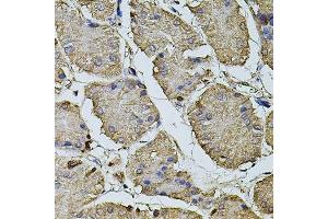 Immunohistochemistry of paraffin-embedded human stomach using CPOX antibody. (CPOX Antikörper  (AA 111-454))