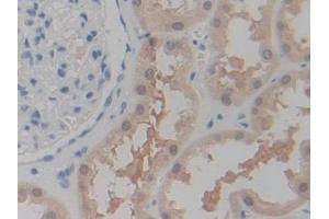 Immunohistochemistry (IHC) image for anti-Purinergic Receptor P2X, Ligand-Gated Ion Channel, 7 (P2RX7) (AA 47-334) antibody (ABIN7436204)