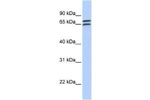 Western Blotting (WB) image for anti-DCP1 Decapping Enzyme Homolog B (DCP1B) antibody (ABIN2459448) (DCP1B Antikörper)