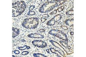 IHC analysis of MTA2 using anti-MTA2 antibody (ABIN7599519).