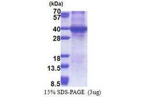 SDS-PAGE (SDS) image for Sprouty RTK Signaling Antagonist 4 (SPRY4) (AA 1-299) protein (His tag) (ABIN5778778)