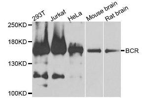 Western blot analysis of extracts of various cell lines, using BCR antibody. (BCR Antikörper  (AA 1-300))