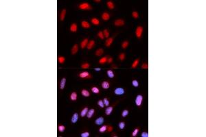 Immunofluorescence analysis of U2OS cells using RFC4 antibody. (RFC4 Antikörper  (AA 204-363))