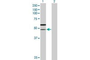 Western Blot analysis of SLC38A3 expression in transfected 293T cell line by SLC38A3 MaxPab polyclonal antibody. (SLC38A3 Antikörper  (AA 1-504))