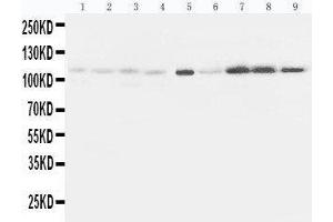 Western Blotting (WB) image for anti-Ephrin Type A Receptor 1 (EPHA1) (AA 963-976), (C-Term) antibody (ABIN3044443)
