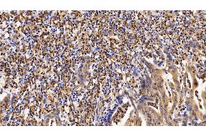 Immunohistochemistry (IHC) image for anti-Interleukin 4 Receptor (IL4R) (AA 26-232) antibody (ABIN7434557)