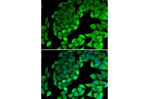 Immunofluorescence analysis of MCF7 cell using RPL14 antibody. (RPL14 Antikörper)