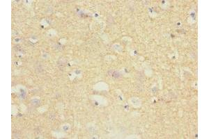 Immunohistochemistry of paraffin-embedded human brain tissue using ABIN7173721 at dilution of 1:100 (Tppp Antikörper  (AA 1-219))