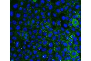 IF analysis of ITGB4 using anti-ITGB4 antibody (ABIN7601134). (Integrin beta 4 Antikörper  (AA 29-431))