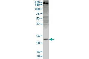 CRYGD monoclonal antibody (M03), clone 4E12 Western Blot analysis of CRYGD expression in HepG2 .