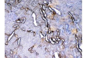 IHC analysis of VEGF Receptor 2 using anti-VEGF Receptor 2 antibody . (VEGFR2/CD309 Antikörper  (AA 20-244))