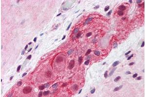Human Small Intestine, Myenteric Plexus: Formalin-Fixed, Paraffin-Embedded (FFPE) (MED17 Antikörper  (AA 551-652))