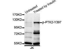 Western blot analysis of extracts of Jurkat cell line, using Phospho-PTK2-Y397 antibody. (FAK Antikörper  (pTyr397))