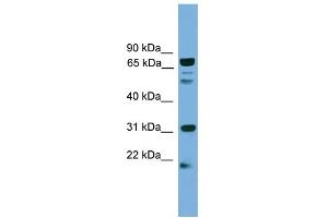 WB Suggested Anti-SLC6A3 Antibody Titration:  0. (SLC6A3 Antikörper  (N-Term))