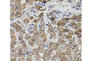 Immunohistochemistry of paraffin-embedded Human liver damage using NTF3 Polyclonal Antibody
