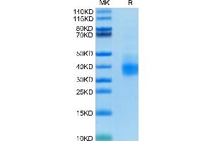 Human PD-L1 on Tris-Bis PAGE under reduced condition. (PD-L1 Protein (AA 19-238) (His tag))