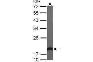 WB Image Sample (50 ug of whole cell lysate) A: Mouse brain 12% SDS PAGE antibody diluted at 1:1000 (HPCAL1 Antikörper)
