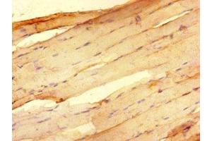 Immunohistochemistry of paraffin-embedded human skeletal muscle tissue using ABIN7151194 at dilution of 1:100