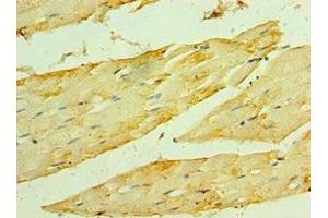Immunohistochemistry of paraffin-embedded human skeletal muscle tissue using ABIN7154911 at dilution of 1:100 (HSPB2 Antikörper  (AA 1-182))