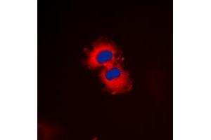 Immunofluorescent analysis of ZAK staining in HeLa cells. (ZAK Antikörper  (C-Term))