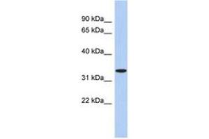 Image no. 1 for anti-Aspartoacylase (ASPA) (AA 71-120) antibody (ABIN6743962) (ASPA Antikörper  (AA 71-120))