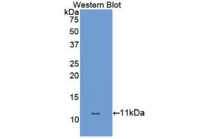 Western blot analysis of the recombinant protein. (SLC6A3 Antikörper  (AA 562-619))