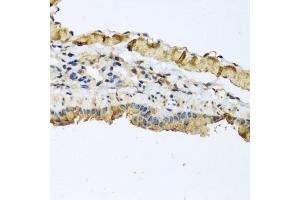 Immunohistochemistry of paraffin-embedded mouse lung using ATP2C1 antibody (ABIN5975353) at dilution of 1/100 (40x lens). (ATP2C1 Antikörper)