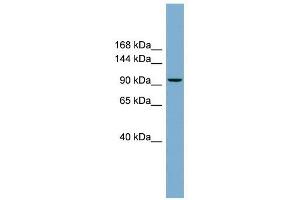 PPP1R3A antibody used at 1 ug/ml to detect target protein. (PPP1R3A Antikörper)