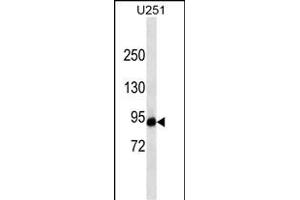 HIF1A ABIN659179 western blot analysis in  cell line lysates (35 μg/lane). (HIF1A Antikörper)