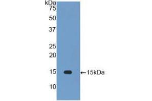 Western blot analysis of recombinant Rat IL34. (IL-34 Antikörper  (AA 21-234))