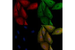 ABIN6264833 and ABIN6279044 staining  cells by IF/ICC. (RPL29 Antikörper  (Internal Region))