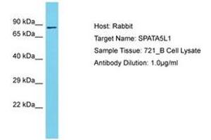 Image no. 1 for anti-Spermatogenesis Associated 5-Like 1 (SPATA5L1) (AA 580-629) antibody (ABIN6750664) (SPATA5L1 Antikörper  (AA 580-629))