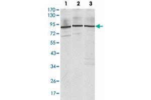 Western blot analysis using IGF2BP3 monoclonal antibody, clone 8F11  against Jurkat (1) , K-562 (2) and NTERA-2 (3) cell lysate. (IGF2BP3 Antikörper)