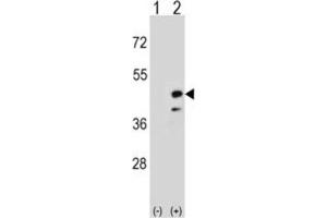 Western Blotting (WB) image for anti-Creatine Kinase, Mitochondrial 2 (Sarcomeric) (CKMT2) antibody (ABIN3002971) (CKMT2 Antikörper)