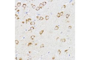 Immunohistochemistry of paraffin-embedded mouse brain using MCL1 Rabbit pAb (ABIN3020787, ABIN3020788, ABIN3020789 and ABIN6213724) at dilution of 1:100 (40x lens). (MCL-1 Antikörper  (AA 120-220))