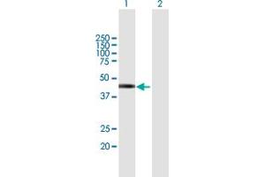 Western Blot analysis of TSPY2 expression in transfected 293T cell line by TSPY2 MaxPab polyclonal antibody.