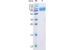 Human DNAM-1 Protein, mFc-His Tag on SDS-PAGE under reducing condition. (CD226 Protein (CD226) (AA 19-247) (mFc-His Tag))