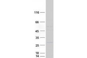 KLRA1 Protein (Myc-DYKDDDDK Tag)
