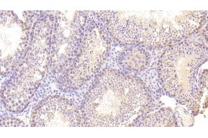 Detection of SCFR in Mouse Testis Tissue using Polyclonal Antibody to Stem Cell Factor Receptor (SCFR)
