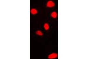 Immunofluorescent analysis of RPL11 staining in H9C2 cells.