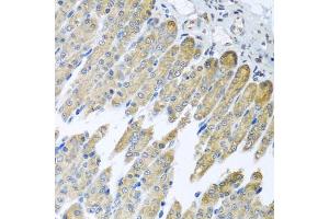 Immunohistochemistry of paraffin-embedded mouse stomach using NDUFB10 antibody (ABIN5972156) at dilution of 1/100 (40x lens). (NDUFB10 Antikörper)