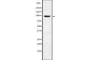 Western blot analysis of TRPV4 using HeLa whole cell lysates (TRPV4 Antikörper  (C-Term))